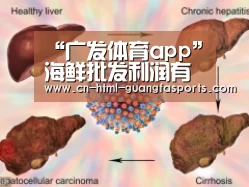 广发体育
